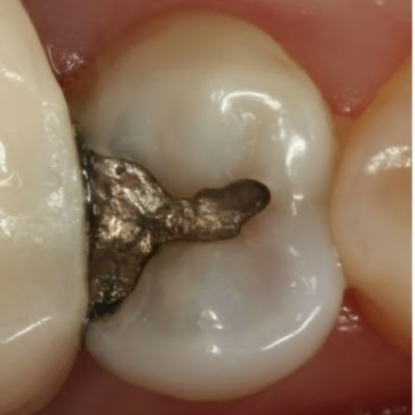 Before & after (4)