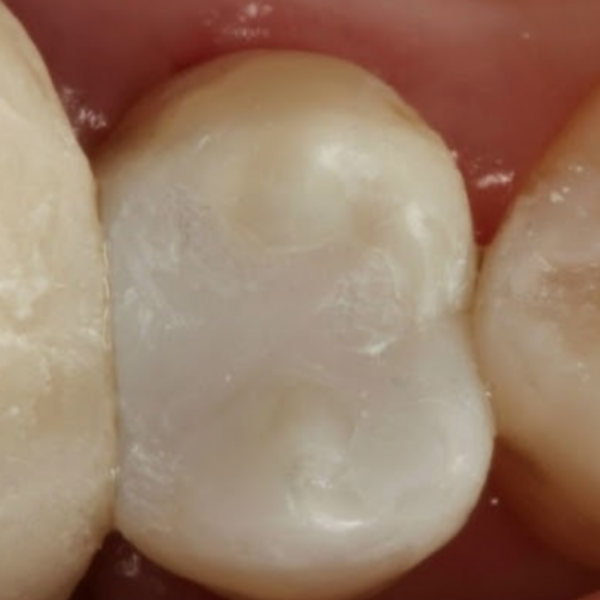 Before & after (5)